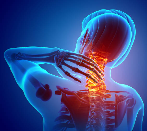 Neck Pain